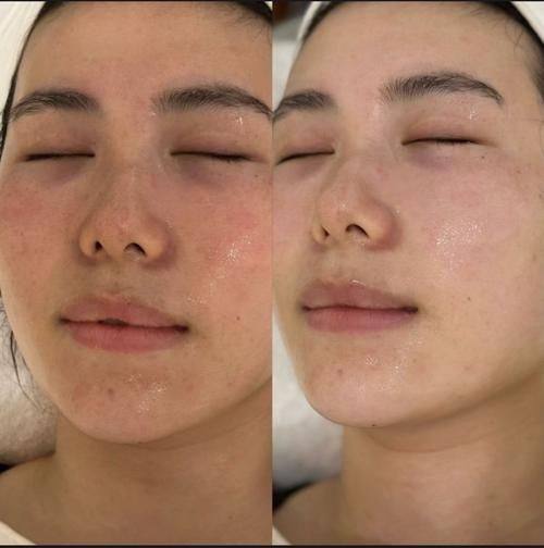 侯露医生价格表