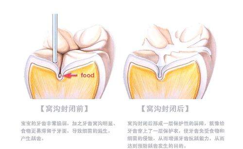 贵州六盘水仁心口腔真人口碑评价怎么样？