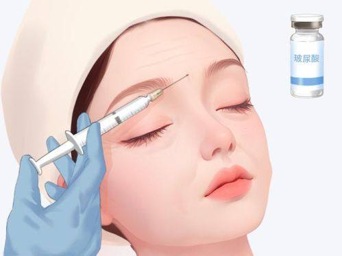 陈静医生擅长项目