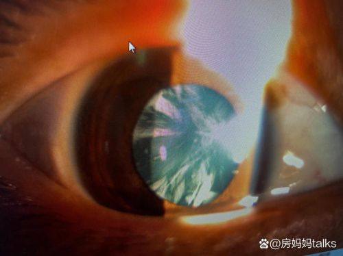 宿州市第一人民医院眼科医生团队实力强大及骨干医生简介