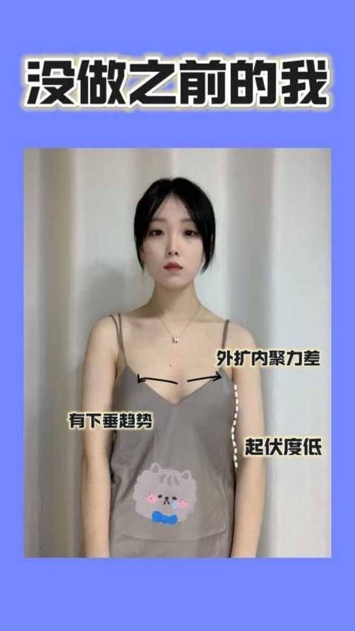 哈尔滨伊尚颜整形医院特色项目及技术优势