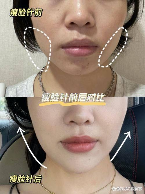 承德凯丽医疗美容门诊部是正规医院吗？