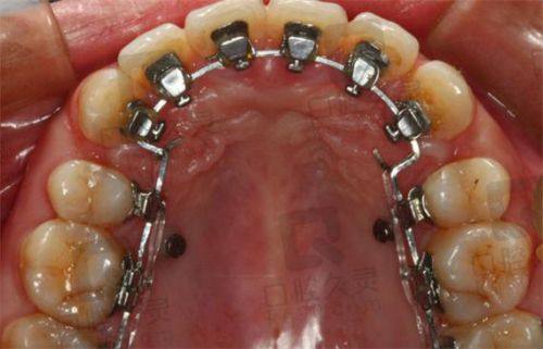 浙江嘉兴平湖山成口腔诊所地址电话营业时间