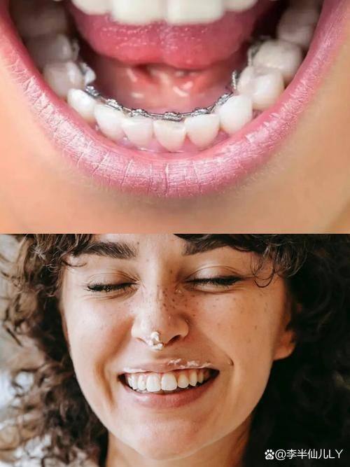 侯露医生技术优势