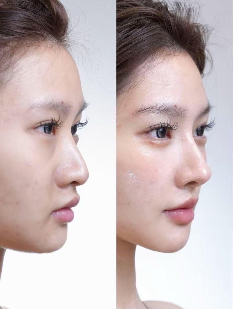 山东青岛李沧美途医疗美容诊所详细的预约挂号方式及流程