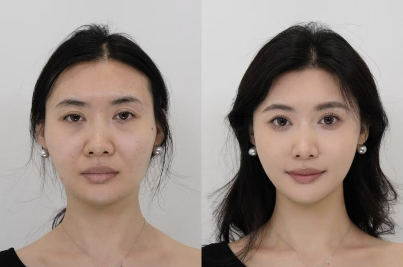 八王子Skin Care特色项目及技术优势