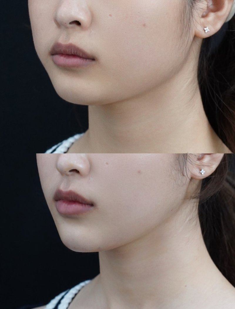 承德凯丽医疗美容门诊部地址电话营业时间