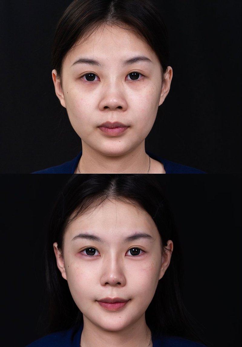 万永莉医生技术优势