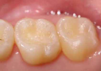 浙江台州三门陈银连口腔是正规医院吗？