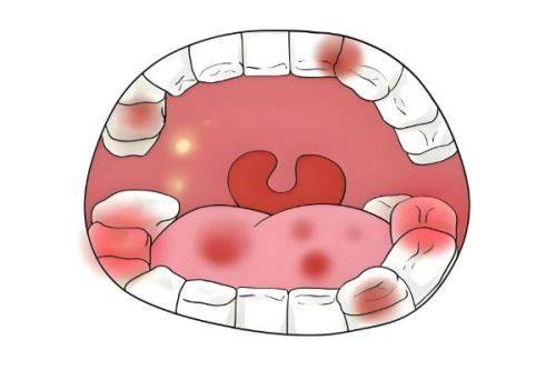 兰晓莉医生坐诊医院