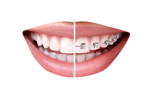 兰晓莉医生技术优势