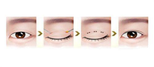 中山南华医疗美容门诊部地址电话营业时间