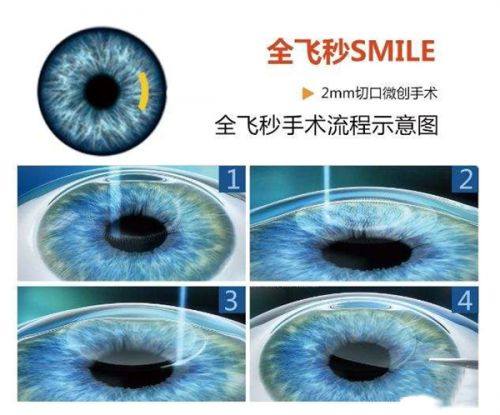 乐至欧普康眼科诊所真人口碑评价怎么样？