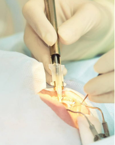 乐至欧普康眼科诊所详细的预约挂号方式及流程