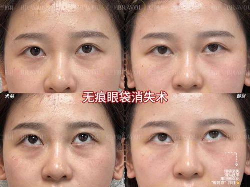 四平唯美医疗美容诊所特色项目及技术优势