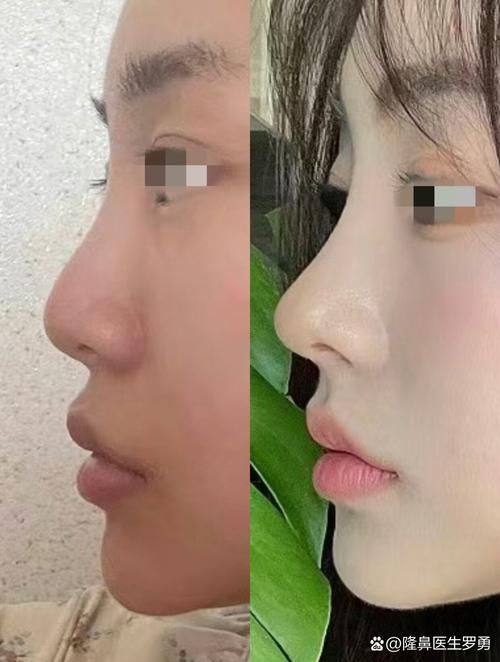 幸福缪斯微整形特色项目及技术优势