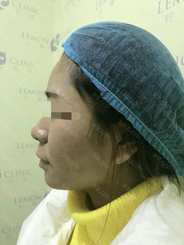 南充市中 心医院整形美容外科收费价格表/收费标准