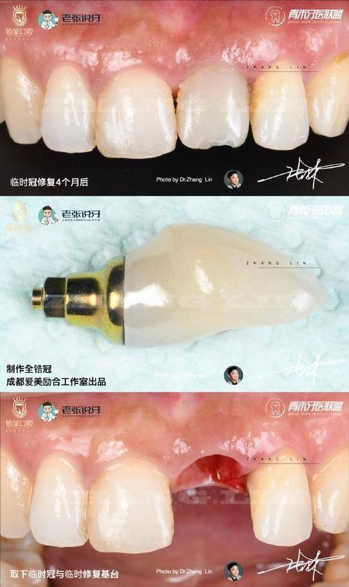 姚森医生口碑评价及真人实例