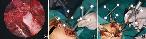 赵冰川医生技术优势