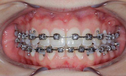 姚森医生擅长项目