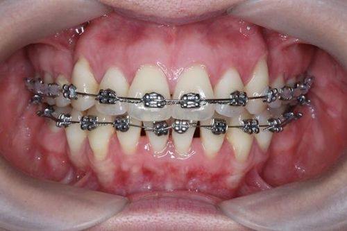 姚森医生价格表