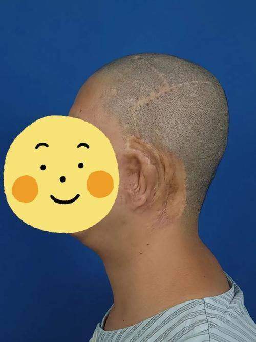 田顺医生价格表