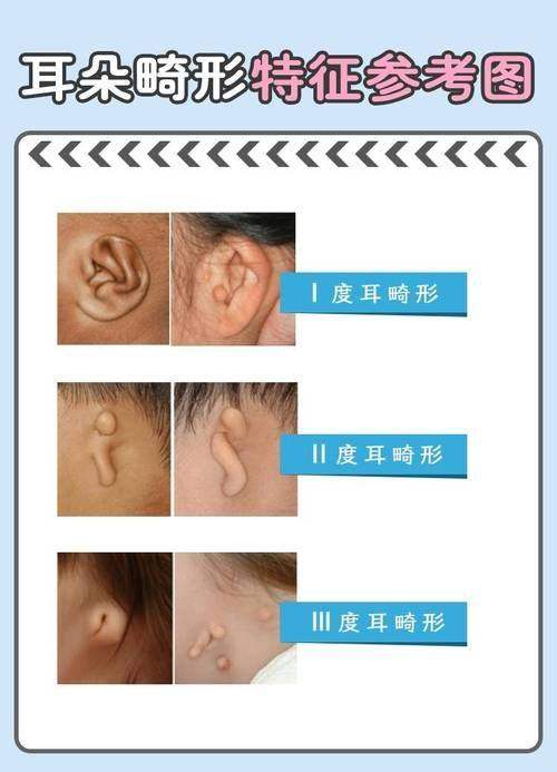 田顺医生技术优势