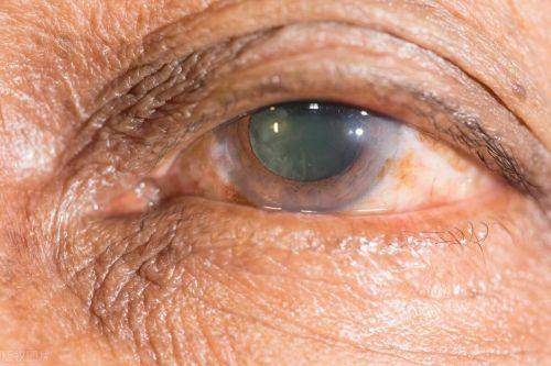 上海未来视界安融眼科门诊（静安店）收费价格表/收费标准