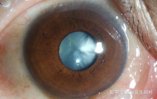 三门峡市中 心医院眼科详细的预约挂号方式及流程