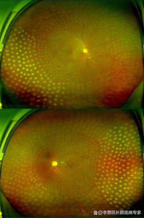 上海未来视界安融眼科门诊（静安店）真人口碑评价怎么样？