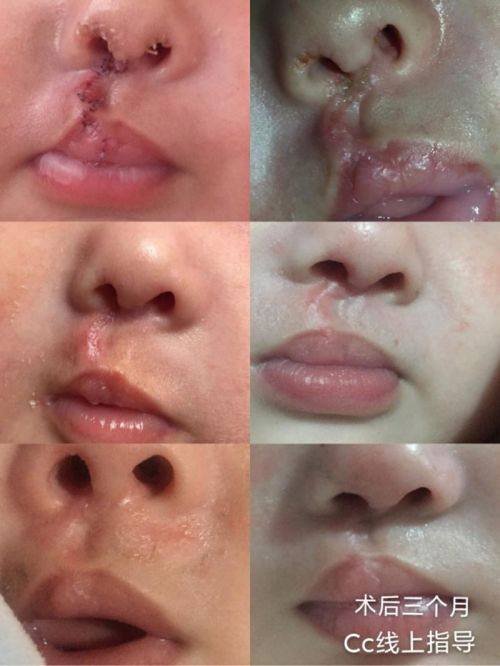 南充市中 心医院整形美容外科详细的预约挂号方式及流程