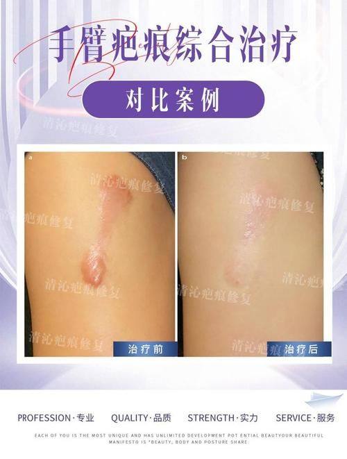 中山南华医疗美容门诊部收费价格表/收费标准