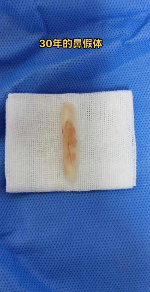 新乡东芳美医疗美容真人口碑评价怎么样？