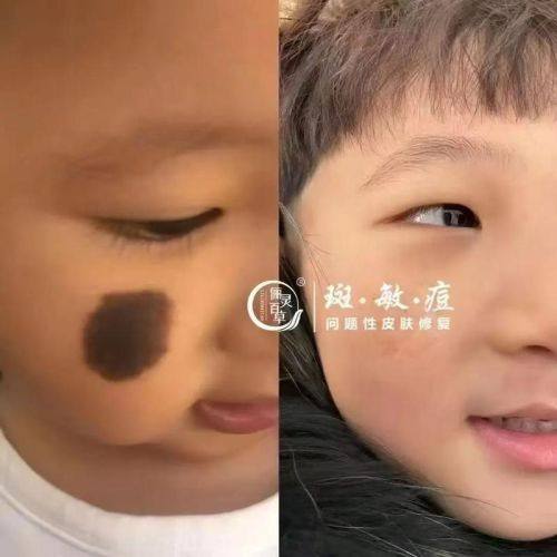 幸福缪斯微整形真人口碑评价怎么样？