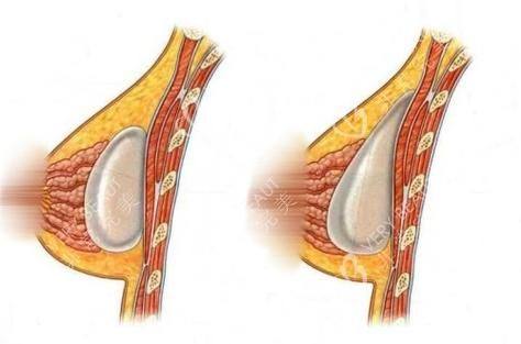 周口雅美天成医疗美容门诊详细的预约挂号方式及流程