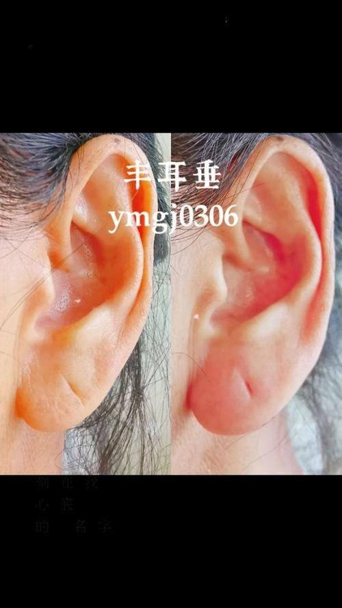 中山南华医疗美容门诊部真人口碑评价怎么样？