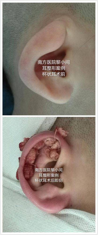 新乡东芳美医疗美容特色项目及技术优势