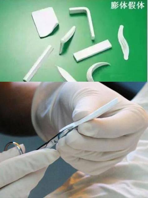 周口雅美天成医疗美容门诊是正规医院吗？