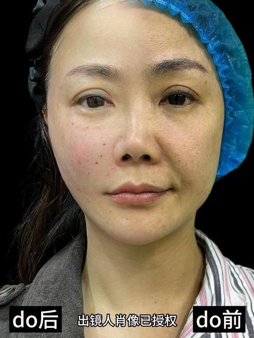 四平唯美医疗美容诊所真人口碑评价怎么样？