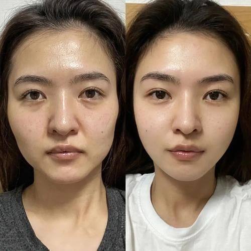 新乡东芳美医疗美容详细的预约挂号方式及流程