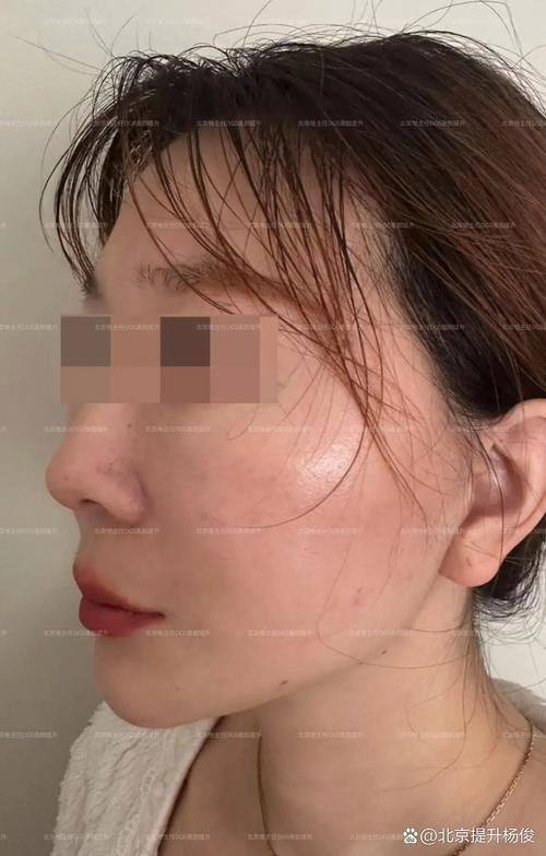 幸福缪斯微整形收费价格表/收费标准