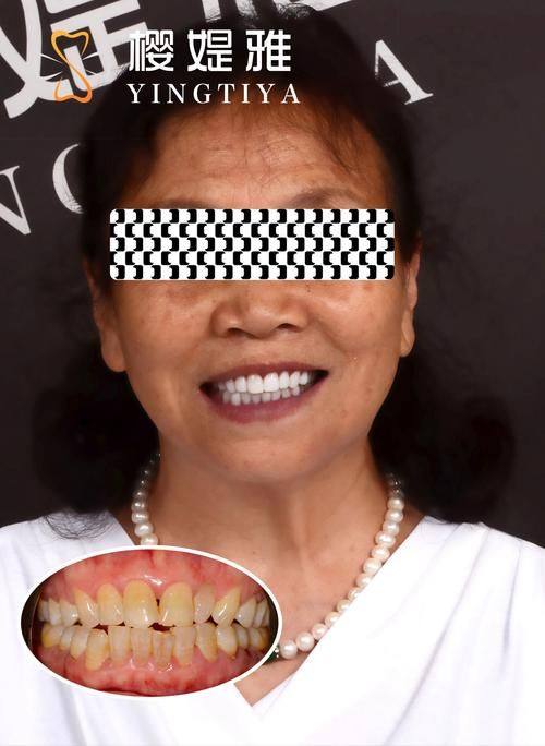 佛山好佰年口腔详细的预约挂号方式及流程