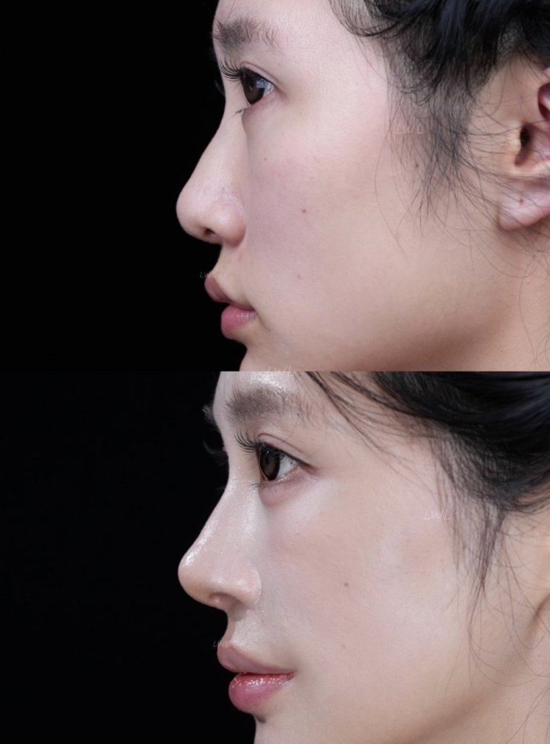 上海君康医院医学美容科真人口碑评价怎么样？