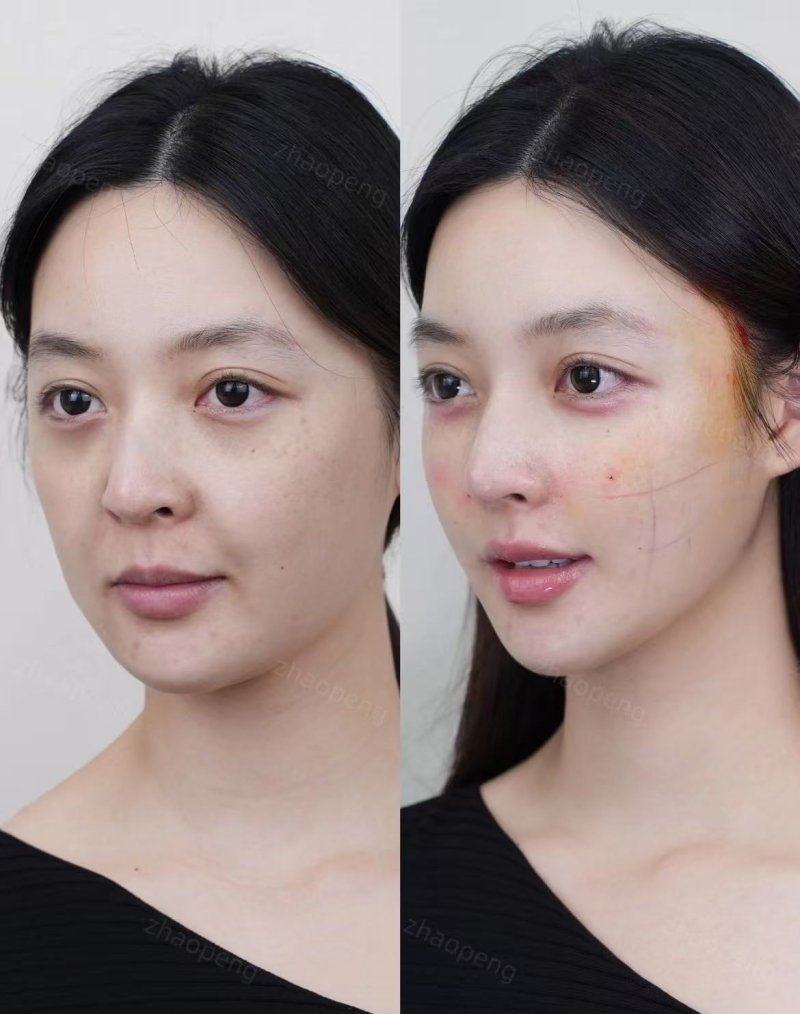 夏兆骥医生技术优势