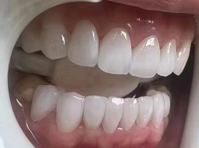 兰晓莉医生价格表