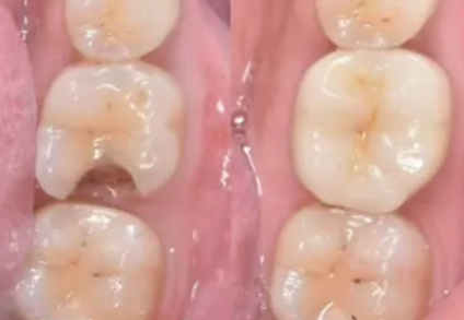 兰晓莉医生预约挂号