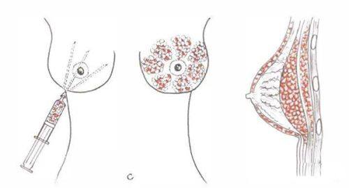 戴浩医生技术优势