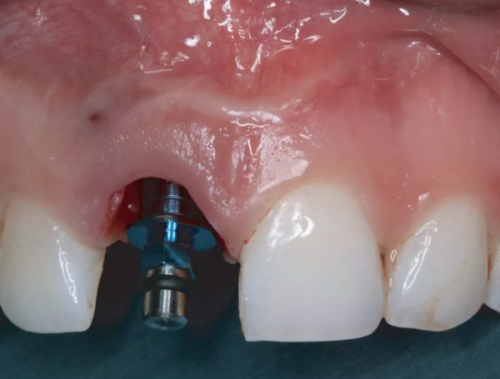 潮州市中心医院口腔科