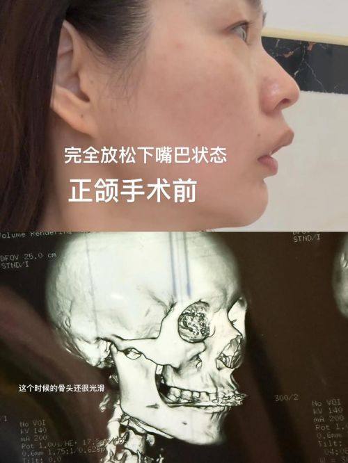 覃寿安医生坐诊医院