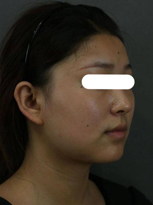 长沙卓而美整形医院是正规医院吗？